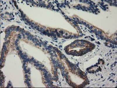 Immunohistochemistry: RASD2 Antibody (OTI1F7) - Azide and BSA Free [NBP2-73808]