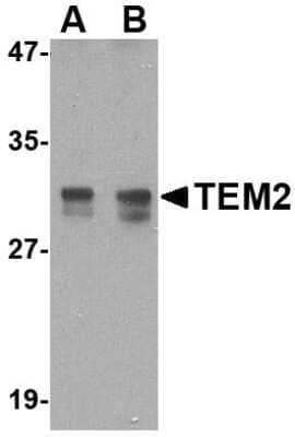 Western Blot: RASD2 AntibodyBSA Free [NBP1-77313]