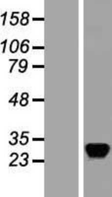 Western Blot: RASD2 Overexpression Lysate [NBL1-15169]