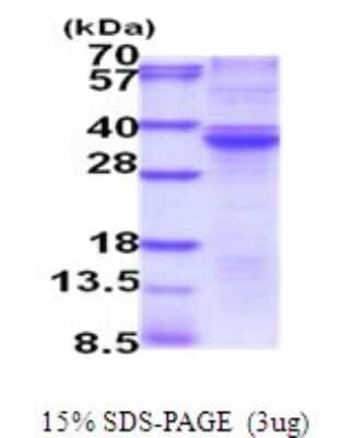 SDS-PAGE: Recombinant Human RASD2 His Protein [NBP2-51981]