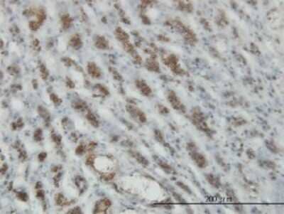 Immunohistochemistry-Paraffin: RASEF Antibody (2D5) [H00158158-M01]