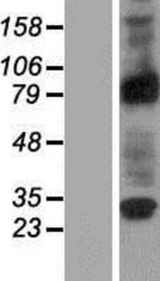 Western Blot: RASEF Overexpression Lysate [NBP2-05339]