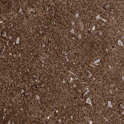 Immunohistochemistry-Paraffin: RASGEF1A Antibody [NBP1-85670]