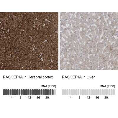 Immunohistochemistry-Paraffin: RASGEF1A Antibody [NBP1-85670]