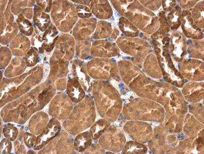 Immunohistochemistry-Paraffin: RASGEF1A Antibody [NBP2-20085]