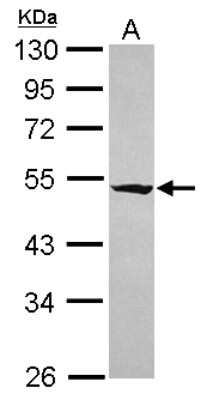 Western Blot: RASGEF1A Antibody [NBP2-20085]