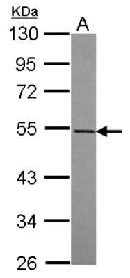 Western Blot: RASGEF1A Antibody [NBP2-20086]