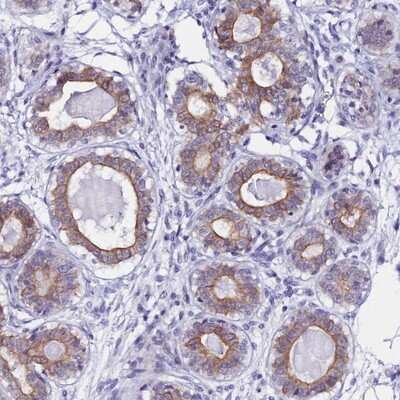 Immunohistochemistry-Paraffin: RASGEF1B Antibody [NBP1-82015]