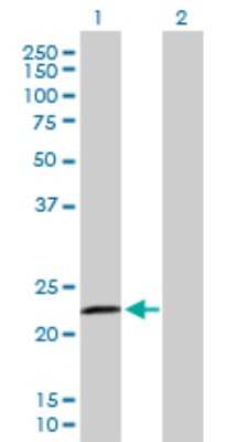 Western Blot: RASGEF1B Antibody [H00153020-B01P]