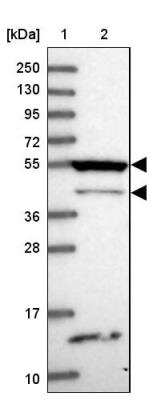 Western Blot: RASGEF1B Antibody [NBP1-82015]