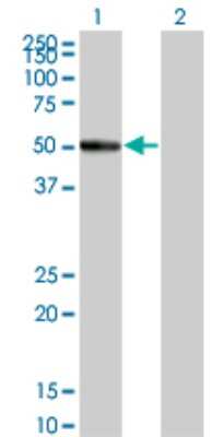 Western Blot: RASGEF1C Antibody (3H8) [H00255426-M01]