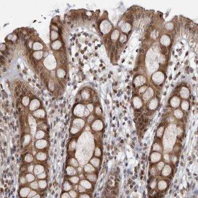 Immunohistochemistry-Paraffin: RASGEF1C Antibody [NBP1-81964]