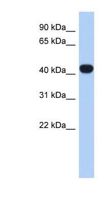 Western Blot: RASGEF1C Antibody [NBP1-58878]