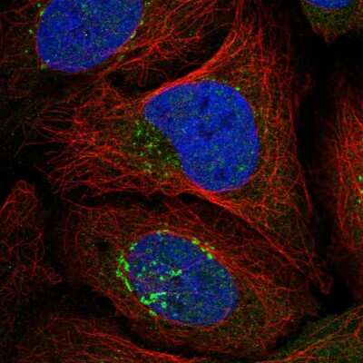 Immunocytochemistry/ Immunofluorescence: RASGRF1 Antibody [NBP1-85727]