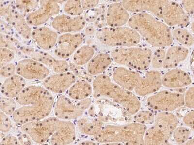 Immunohistochemistry: RASGRF1 Antibody [NBP3-06655]