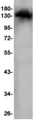 Western Blot: RASGRF1 Antibody (S06-5H5) [NBP3-19949]