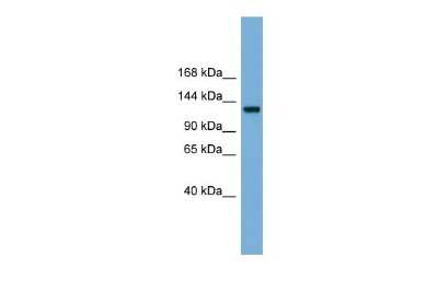 Western Blot: RASGRF1 Antibody [NBP2-85603]
