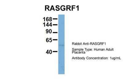 Western Blot: RASGRF1 Antibody [NBP2-85603]