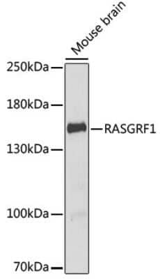 Western Blot: RASGRF1 AntibodyBSA Free [NBP2-95233]