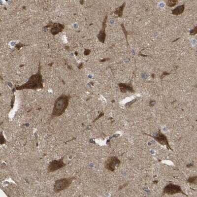 Immunohistochemistry-Paraffin: RASGRF2 Antibody [NBP1-83331]