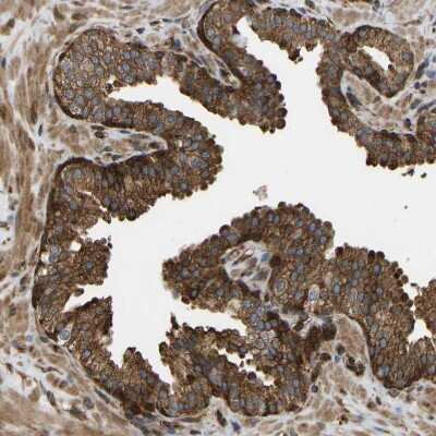 Immunohistochemistry-Paraffin: RASGRF2 Antibody [NBP1-83331]