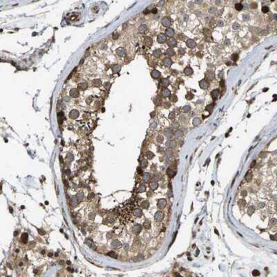 Immunohistochemistry-Paraffin: RASGRF2 Antibody [NBP1-83331]