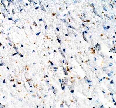 Immunohistochemistry-Paraffin: RASGRF2 Antibody [NBP3-12339]