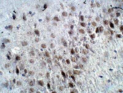 Immunohistochemistry-Paraffin: RASGRF2 Antibody [NBP3-12339]