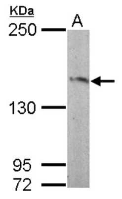 Western Blot: RASGRF2 Antibody [NBP2-20088]