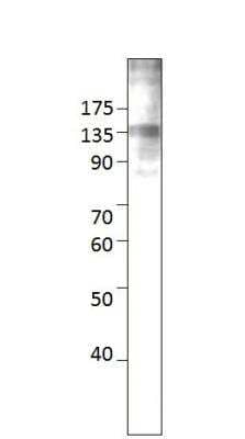 Western Blot: RASGRF2 Antibody [NBP3-12339]