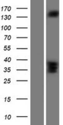 Western Blot: RASGRF2 Overexpression Lysate [NBP2-07560]