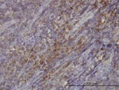 Immunohistochemistry-Paraffin: RASGRP 4 Antibody (1F3) [H00115727-M01]