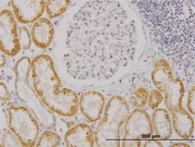 Immunohistochemistry-Paraffin: RASGRP 4 Antibody (6D3) [H00115727-M02]