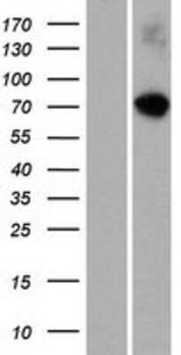 Western Blot: RASGRP 4 Overexpression Lysate [NBP2-05215]