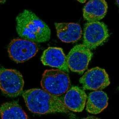 Immunocytochemistry/ Immunofluorescence: RASGRP2 Antibody [NBP3-17921]