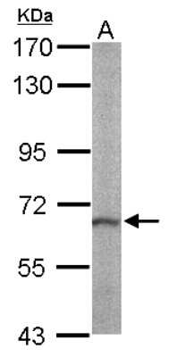 Western Blot: RASGRP2 Antibody [NBP1-33315]