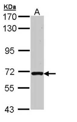 Western Blot: RASGRP2 Antibody [NBP1-33315]