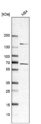 Western Blot: RASGRP2 Antibody [NBP1-86661]