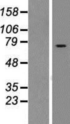 Western Blot: RASGRP2 Overexpression Lysate [NBP2-05229]