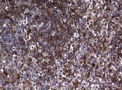 Immunohistochemistry: RASGRP3 Antibody (OTI2C11) [NBP2-45528]