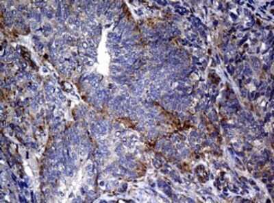 Immunohistochemistry: RASGRP3 Antibody (OTI2C11) [NBP2-45528]