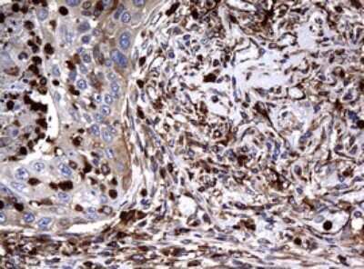 Immunohistochemistry: RASGRP3 Antibody (OTI2C11) [NBP2-45528]
