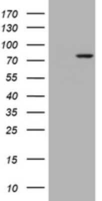 Western Blot: RASGRP3 Antibody (OTI2C11) [NBP2-45528]