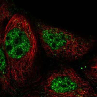 Immunocytochemistry/ Immunofluorescence: RASGRP3 Antibody [NBP2-58546]