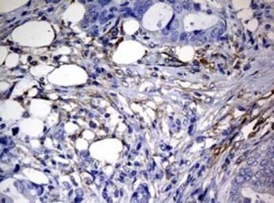Immunohistochemistry: RASGRP3 Antibody (OTI2C11) - Azide and BSA Free [NBP2-73812]