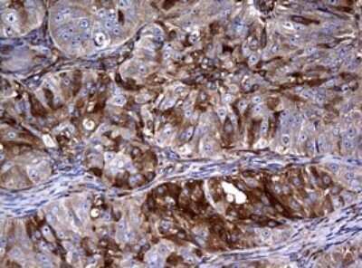 Immunohistochemistry: RASGRP3 Antibody (OTI2C11) - Azide and BSA Free [NBP2-73812]