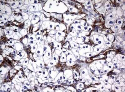 Immunohistochemistry: RASGRP3 Antibody (OTI2C11) - Azide and BSA Free [NBP2-73812]