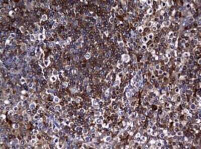 Immunohistochemistry: RASGRP3 Antibody (OTI2C11) - Azide and BSA Free [NBP2-73812]