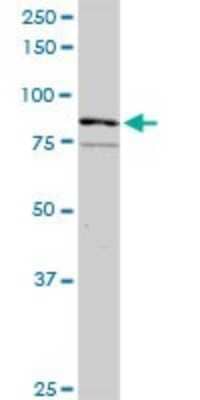 Western Blot: RASGRP3 Antibody [H00025780-D01P]