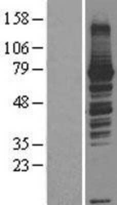 Western Blot: RASGRP3 Overexpression Lysate [NBL1-15171]